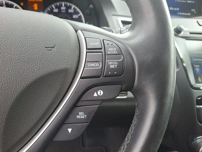 2017 Acura RDX Technology Package